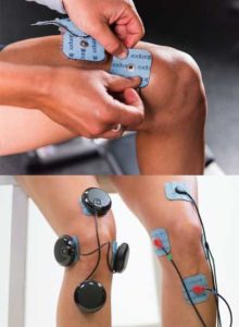 elektrostymulacja kolana bole kolana