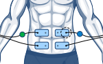 compex electrodes stomach