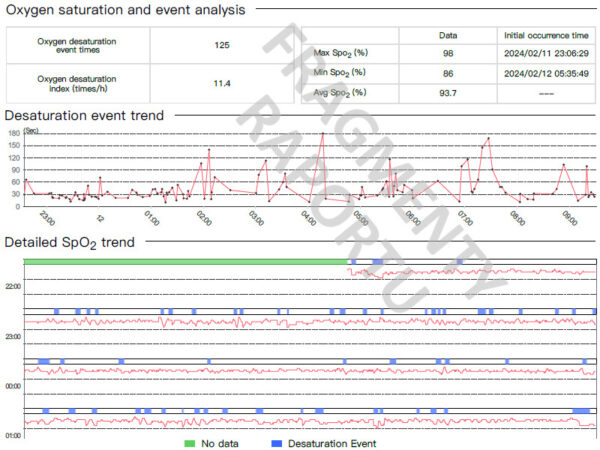 pulsoksymetr-nagwarstkowy-choicemmed-w628-analiza-snu-2